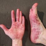 “Honduras y Costa Rica en el filo de la desesperación: la suerte de Piojo Herrera y Keylor Navas está en juego en un partido decisivo que podrá enviar a uno de ellos al abismo del Mundial 2026”